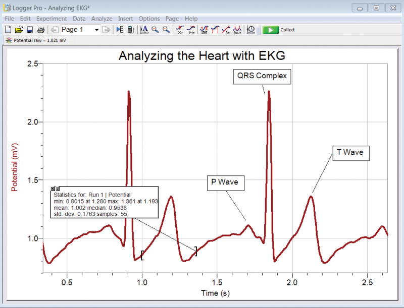 screenshot_lp_ekg-bta__heart-rate__physiology_001_800_611.png
